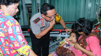 Polda Jambi Bantu Cahaya Ilahi Penderita Tumor Leher